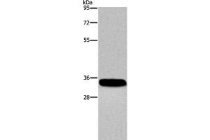 Western Blot analysis of Human normal lung tissue using CA4 Polyclonal Antibody at dilution of 1:300 (CA4 antibody)
