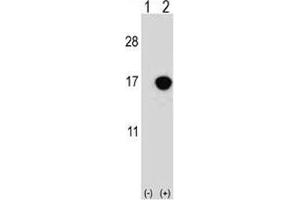 Western blot analysis of CDKN2B antibody and 293 cell lysate either nontransfected (Lane 1) or transiently transfected (2) with the CDKN2B gene. (CDKN2B antibody  (AA 102-130))