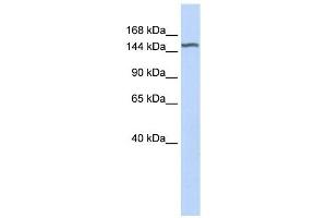 DGKH antibody used at 1 ug/ml to detect target protein. (DGKH antibody  (Middle Region))