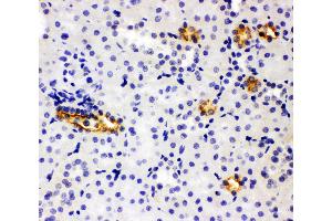 Anti-SLC12A1 antibody, IHC(P) IHC(P): Rat Kidney Tissue (SLC12A1 antibody  (N-Term))
