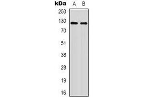 Western blot analysis of XPO1 (AcK568) expression in HepG2 UV-treated (A), mouse brain (B) whole cell lysates. (XPO1 antibody  (acLys568))
