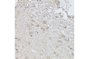 Immunohistochemistry of paraffin-embedded rat brain using PP2A-B56δ/PR61δ/PP2A-B56δ/PR61δ/PPP2R5D antibody (ABIN7269690) at dilution of 1:100 (40x lens). (PPP2R5D antibody  (AA 450-550))