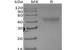 Western Blotting (WB) image for Colony Stimulating Factor 1 (Macrophage) (CSF1) protein (ABIN7321260) (M-CSF/CSF1 Protein)