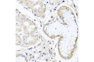 Immunohistochemistry of paraffin-embedded human gastric using INPP5K antibody at dilution of 1:100 (x40 lens). (INPP5K antibody)