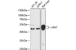 Western blot analysis of extracts of various cell lines, using Lrat antibody (ABIN6132017, ABIN6143311, ABIN6143314 and ABIN6217073) at 1:3000 dilution. (LRAT antibody  (AA 31-150))