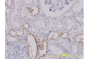 Image no. 1 for anti-Solute Carrier Family 25 (Mitochondrial Carrier, Oxoglutarate Carrier), Member 11 (SLC25A11) (AA 1-315) antibody (ABIN599038) (SLC25A11 antibody  (AA 1-315))