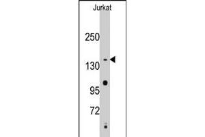 Western blot analysis of SMC2 polyclonal antibody  in Jurkat cell line lysates (35 ug/lane). (SMC2 antibody  (C-Term))