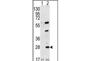 Western blot analysis of GREM1 (arrow) using rabbit polyclonal GREM1 Antibody (C-term) (ABIN656181 and ABIN2845510). (GREM1 antibody  (C-Term))