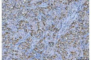 IHC analysis of FMRP/FMR1 using anti-FMRP/FMR1 antibody (ABIN3042398). (FMR1 antibody  (N-Term))