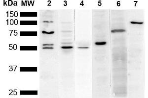Western Blot analysis of Human Cervical cancer cell line (HeLa) lysate showing detection of Multiple KDEL protein using Mouse Anti-KDEL Monoclonal Antibody, Clone 2C1 (ABIN5650522). (KDEL antibody  (N-Term) (Biotin))