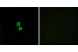 Immunofluorescence analysis of MCF7 cells, using CKLF1 Antibody. (CKLF antibody  (AA 120-169))