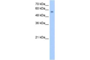 Western Blotting (WB) image for anti-Nudix (Nucleoside Diphosphate Linked Moiety X)-Type Motif 12 (NUDT12) antibody (ABIN2463240) (NUDT12 antibody)