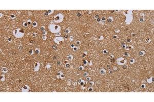 Immunohistochemistry of paraffin-embedded Human brain tissue using IFRD1 Polyclonal Antibody at dilution 1:40 (IFRD1 antibody)