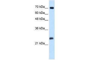 WB Suggested Anti-SERTAD1 Antibody Titration:  0. (SERTAD1 antibody  (N-Term))