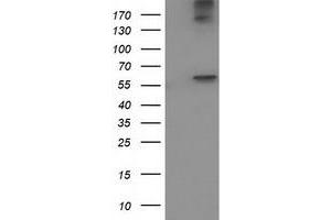 HEK293T cells were transfected with the pCMV6-ENTRY control (Left lane) or pCMV6-ENTRY ACOT12 (Right lane) cDNA for 48 hrs and lysed. (ACOT12 antibody)