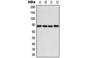 Western blot analysis of BMX (pY40) expression in MCF7 IL1b-treated (A), Jurkat CD3-treated (B), Raw264.