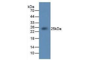 Detection of TF in Rabbit Brain Tissue using Monoclonal Antibody to Tissue Factor (TF) (Tissue factor antibody  (AA 33-292))