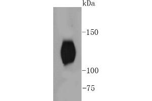 Mouse brain lysates, probed with TrkB(Y817) (2A1 ) Monoclonal Antibody  at 1:1000 overnight at 4˚C. (TRKB antibody  (pTyr817))