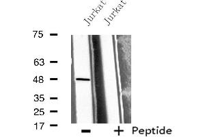 Western blot analysis of extracts from Jurkat cells, using BMP10 antibody.