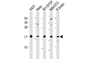 All lanes : Anti-hCalmodulin- at 1:2000 dilution Lane 1: A431 whole cell lysate Lane 2: Hela whole cell lysate Lane 3: SH-SY5Y whole cell lysate Lane 4: NIH/3T3 whole cell lysate Lane 5: Rat brain lysate Lysates/proteins at 20 μg per lane. (Calmodulin 1 antibody  (C-Term))