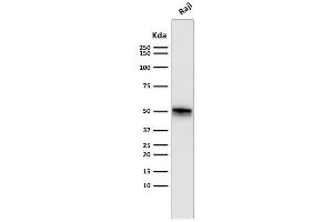 Western Blot Analysis of Raji cell lysate using CD79a Monoclonal Antibody (SPM550).