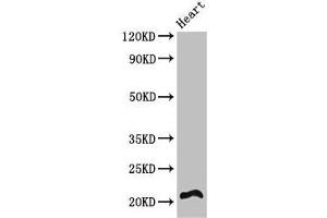Western Blot Positive WB detected in: Mouse heart tissue All lanes: RCAN2 antibody at 3 μg/mL Secondary Goat polyclonal to rabbit IgG at 1/50000 dilution Predicted band size: 22, 28 kDa Observed band size: 22 kDa