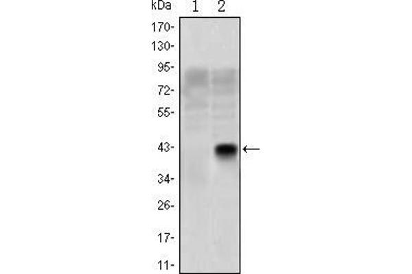 OLIG2 antibody