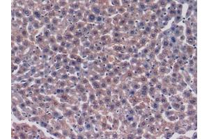 Used in DAB staining on fromalin fixed paraffin-embedded Heart tissue (FKBP3 antibody  (AA 2-224))