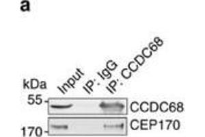 CCDC68 interacts with CEP170 and is localized at the centrosomes.