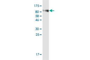 Western Blot detection against Immunogen (71. (MCAM antibody  (AA 24-646))