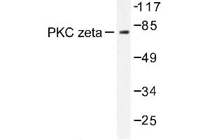 Image no. 2 for anti-Protein Kinase C, zeta (PRKCZ) antibody (ABIN272064)