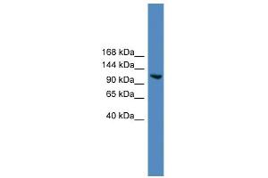 WB Suggested Anti-USP7 Antibody Titration: 0. (USP7 antibody  (Middle Region))