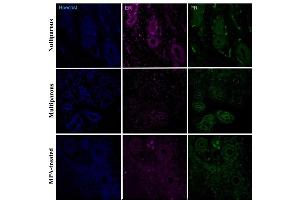 Immunohistochemical detection of progesterone receptor (PR) and estradiol receptor (ER-a) in the basal region of the endometrium in uteri of nulliparous, multiparous and MPA-treated dogs. (Progesterone Receptor antibody  (AA 501-600) (Alexa Fluor 488))