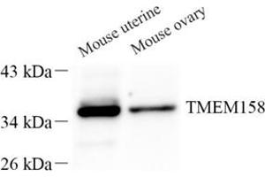 Western blot analysis of TMEM158 (ABIN7075993) at dilution of 1: 500
