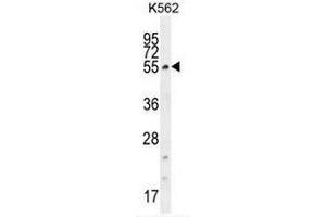 CCDC61 Antibody (N-term) western blot analysis in K562 cell line lysates (35µg/lane). (CCDC61 antibody  (N-Term))