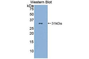 Western Blotting (WB) image for anti-CD86 (CD86) (AA 46-282) antibody (ABIN1859589) (CD86 antibody  (AA 46-282))