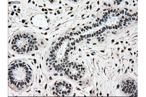 Immunohistochemical staining of paraffin-embedded breast tissue using anti-SCYL3 mouse monoclonal antibody.