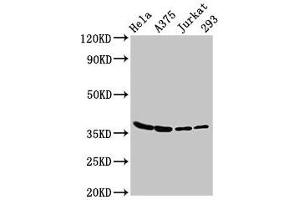 Western Blot Positive WB detected in: Hela whole cell lysate, A375 whole cell lysate, Jurkat whole cell lysate, 293 whole cell lysate All lanes: LDHA antibody at 3 μg/mL Secondary Goat polyclonal to rabbit IgG at 1/50000 dilution Predicted band size: 37, 31, 40, 27 kDa Observed band size: 37 kDa (Lactate Dehydrogenase A antibody  (AA 5-323))