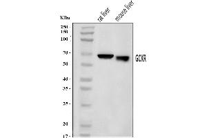 Western blot analysis of GCKR using anti-GCKR antibody (ABIN7602493).