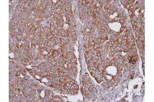 IHC-P Image Immunohistochemical analysis of paraffin-embedded NCI-N87 xenograft, using SEC31A, antibody at 1:100 dilution. (SEC31A antibody  (N-Term))