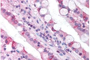 Human Small Intestine (formalin-fixed, paraffin-embedded) stained with CLDN18 antibody ABIN214745 at 5 ug/ml followed by biotinylated goat anti-rabbit IgG secondary antibody ABIN481713, alkaline phosphatase-streptavidin and chromogen. (Claudin 18 antibody  (C-Term))