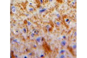Used in DAB staining on fromalin fixed paraffin-embedded Brain tissue (DKK2 antibody  (AA 159-258))