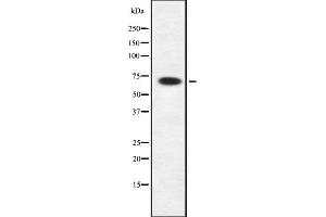 Western blot analysis of Rab11-FIP4 using HepG2 whole cell lysates (RAB11FIP4 antibody  (Internal Region))