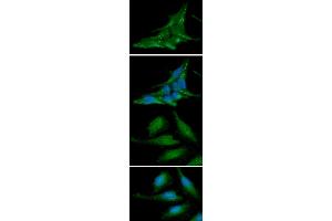 ICC/IF analysis of alpha-synuclein in LnCap cells line, stained with DAPI (Blue) for nucleus staining and monoclonal anti-human alpha-synuclein antibody (1:100) with goat anti-mouse IgG-Alexa fluor 488 conjugate (Green) ICC/IF analysis of alpha-synuclein in HeLa cells line, stained with DAPI (Blue) for nucleus staining and monoclonal anti-human alpha-synuclein antibody (1:100) with goat anti-mouse IgG-Alexa fluor 488 conjugate (Green) (SNCA antibody  (AA 1-140))