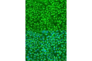 Immunofluorescence analysis of U2OS cells using GZMA antibody. (GZMA antibody  (AA 29-262))