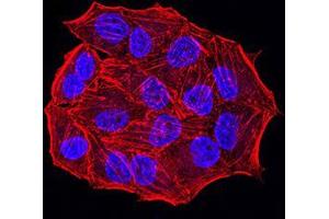 Immunofluorescence analysis of Hela cells using ESR1 mouse mAb.
