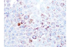 Immunohistochemistry of paraffin-embedded mouse liver using Cathepsin L/V/K/H Rabbit mAb (ABIN7266150) at dilution of 1:100 (40x lens). (Cathepsin L antibody)