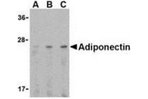 Western blot analysis of adiponectin in HL60 cell lysate with AP30022PU-N adiponectin antibody at (A) 0.
