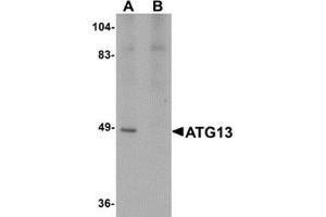 Western blot analysis of ATG13 in rat heart tissue lysate with ATG13 antibody at 1 μg/ml in (A) the absence and (B) the presence of blocking peptide. (ATG13 antibody  (C-Term))