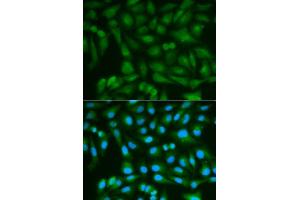 Immunofluorescence analysis of MCF7 cell using SORD antibody. (SORD antibody  (AA 1-357))